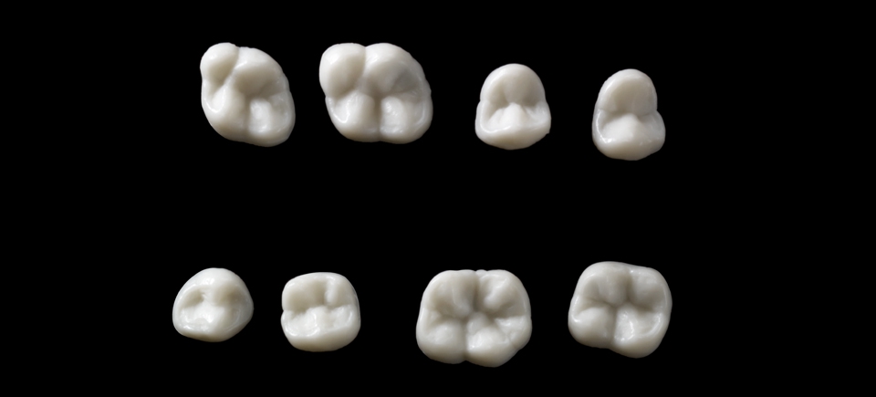 New Architect,4 Seitenzahn-Silikonformen New Architect,4 Seitenzahn-Silikonformen